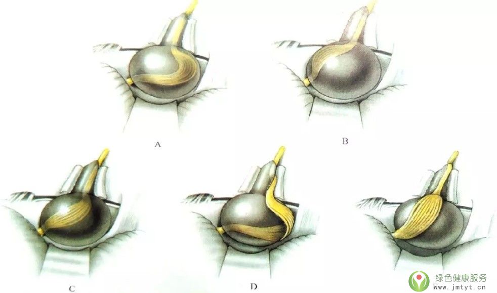 ���� ����