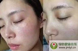 ˼F(tun)(i)_So(h)w׺